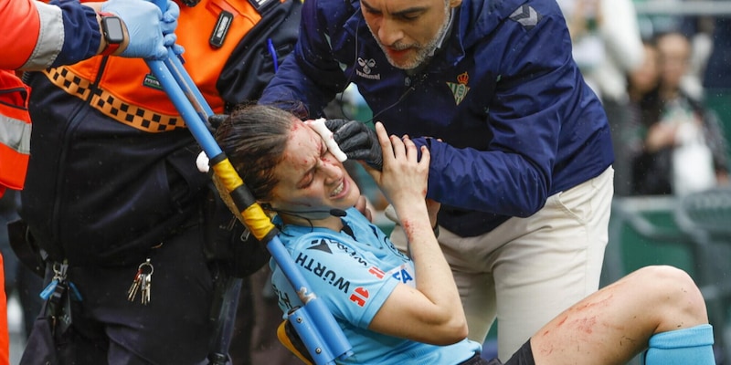 Infortunio shock per la guardalinee di Betis-Athletic: scontro con la telecamera e sangue al volto