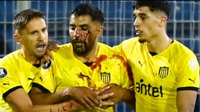 Uruguay sotto shock, l’ex Fiorentina è una maschera di sangue: cosa è successo