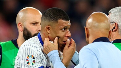 Mbappé, niente operazione al naso: “Idee per una maschera?”